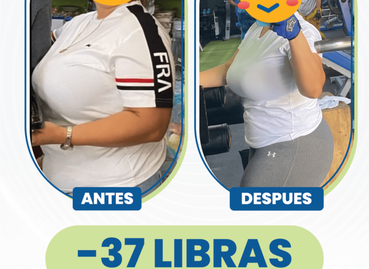 Comparación del antes y el despues de que una mujer perdiera 37 libras