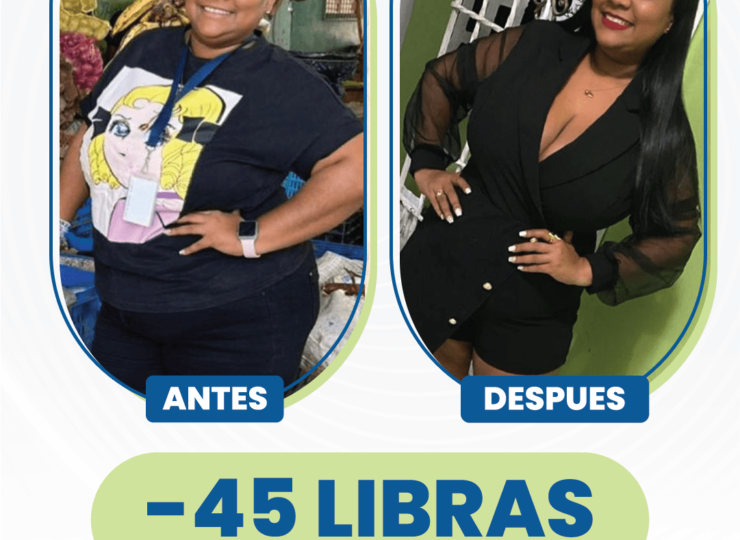 Comparación de una mujer antes y despues de perder 45 libras en 3 meses