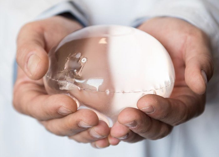 Manos de un doctor sujetando un balón gástrico, una herramienta médica similar a un globo transparente lleno de líquido.